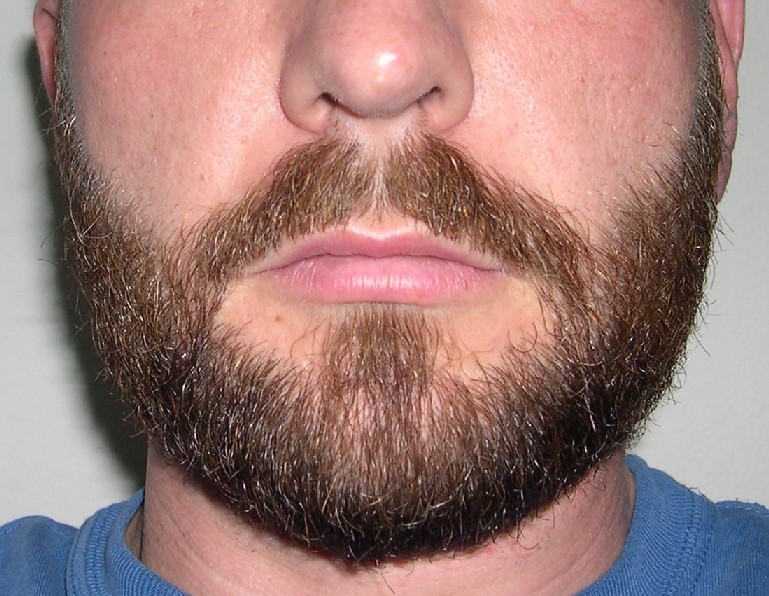 Рост волос на лице у мужчин. Борода. Легкая щетина. Густая борода. Отращивание бороды.
